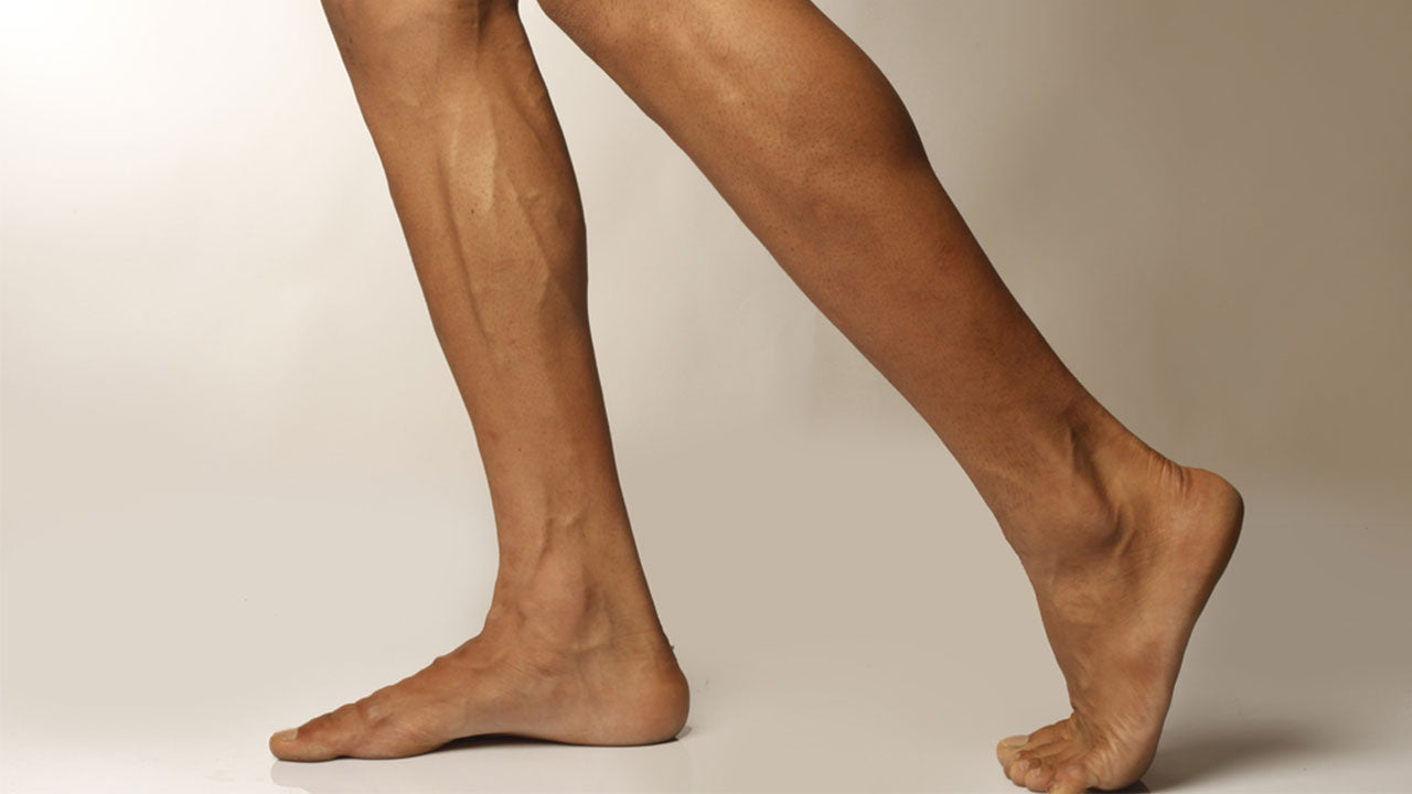 Do you keep pulling your calf ? Learn more about Calf Muscle
