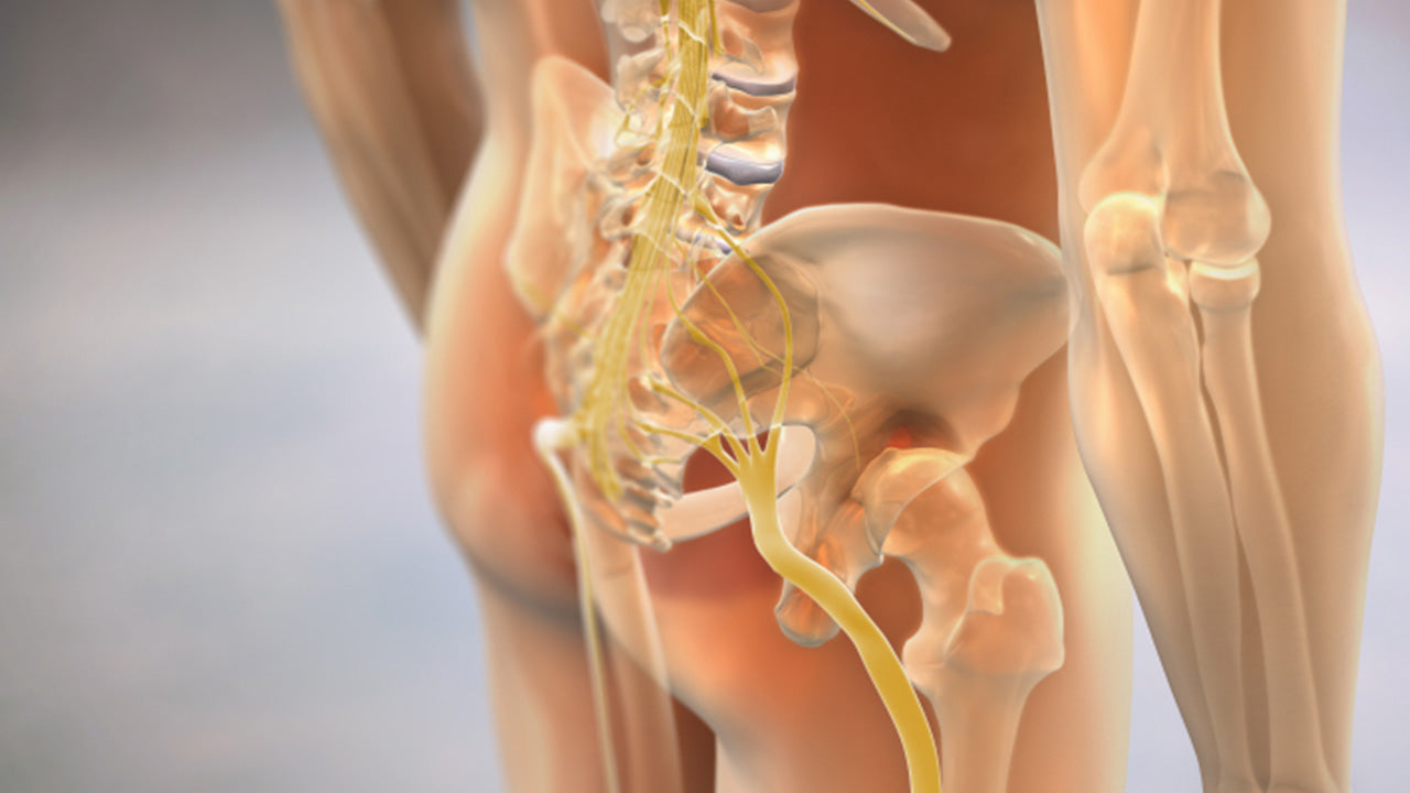 Pinched Nerve in Hip? Everything to Know About Treatment & Prevention – The  Amino Company