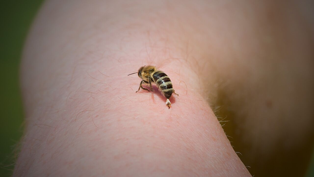 bee bite